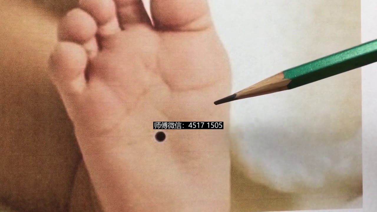 脚底痣相大全插图