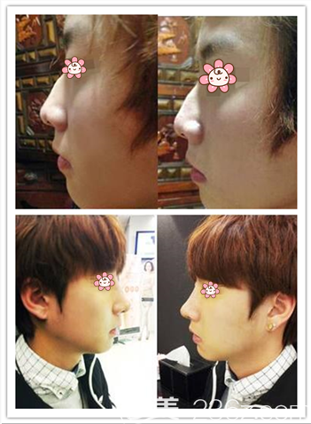 建议,揭秘有福男人面相特征,五官小巧、声音宏亮等成关键要素!插图 建议,揭秘有福男人面相特征,五官小巧、声音宏亮等成关键要素!插图