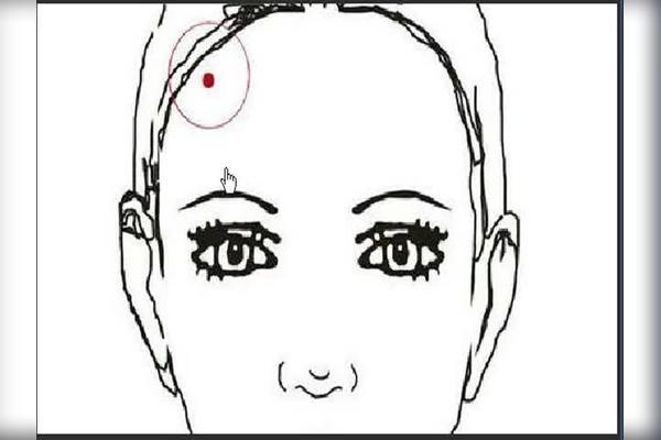 脸部痣相详解，不同位置含义大解析插图