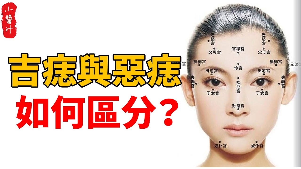 面部痣相解析，吉凶一览表插图