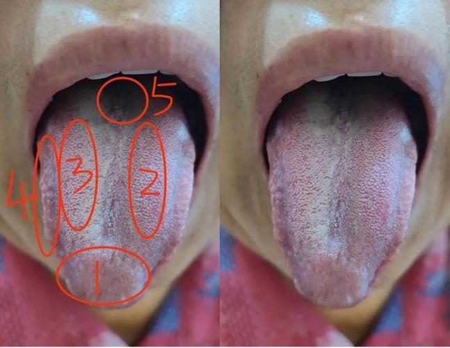 梦见舌头掉落的多重解读，沟通障碍、内心焦虑与运势波动预警插图