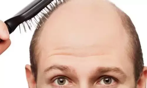 梦见秃头预示着什么插图