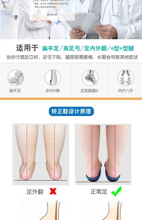 内八字矫正鞋有效纠正轻度畸形插图