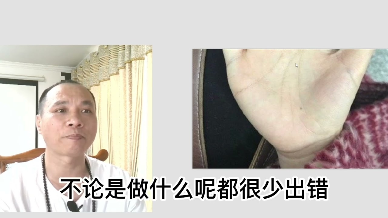 女人掌心痣相解析，富贵之兆插图