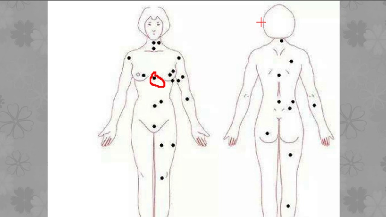 女性痣相图解，胸部与命运相连插图