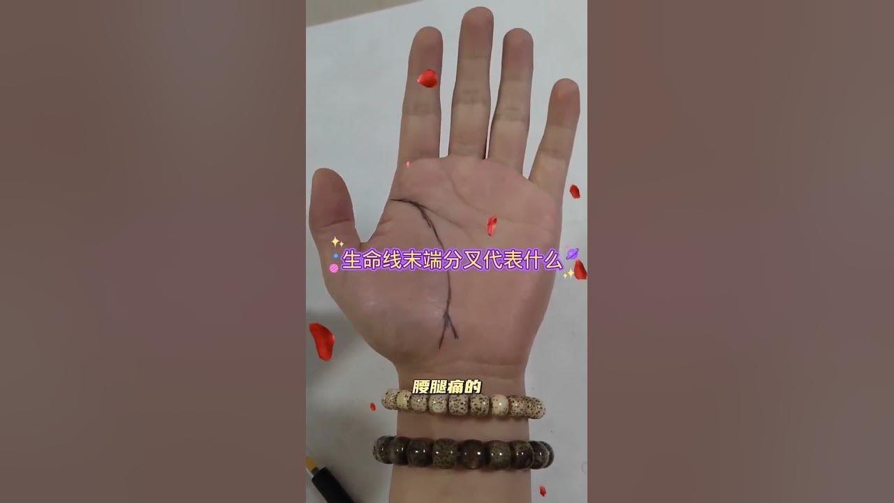 手相解读生命线，断裂与分叉预示的健康及命运挑战插图