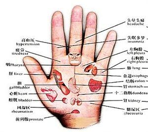 手相看病揭秘，真假难辨，警惕骗局！插图