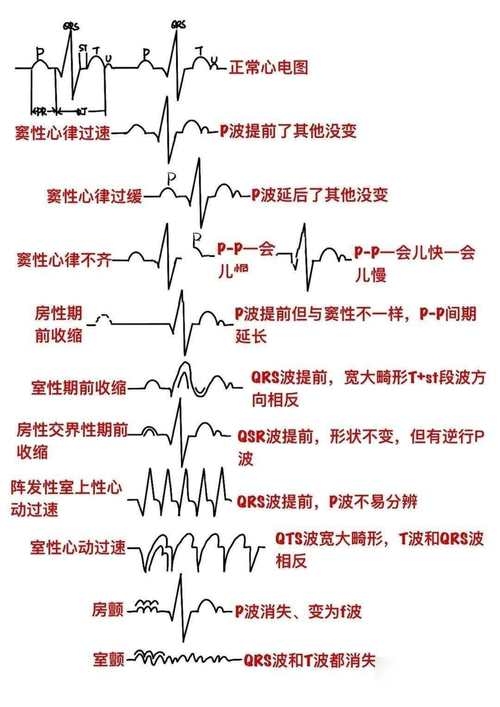 世纪佳缘心电感应真实情况分析插图