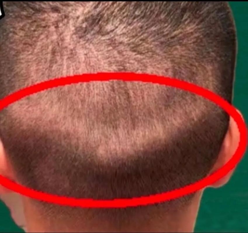 天生反骨，指枕骨突出的人。插图