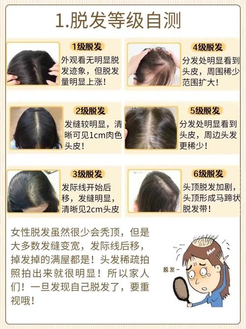 秃的意思头发脱落或稀少插图