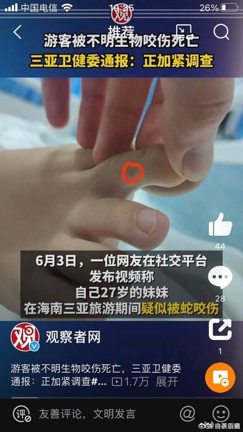 蛇进屋男子被银环蛇缠脚后处理插图