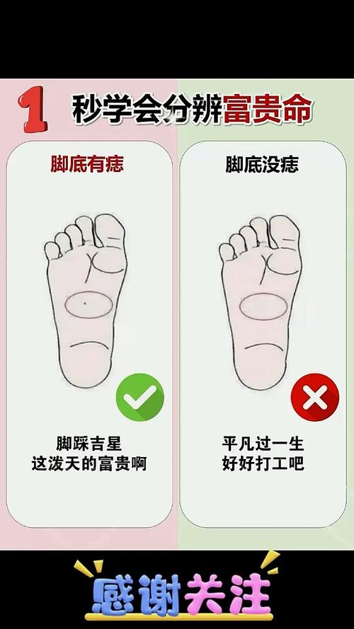 男人脚底痣相，富贵象征与命运解读插图
