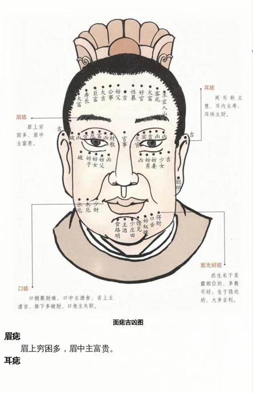 男人面部痣相图解详解，吉凶、财运与健康预示的解读标题如下，，男子面痣解析手册插图