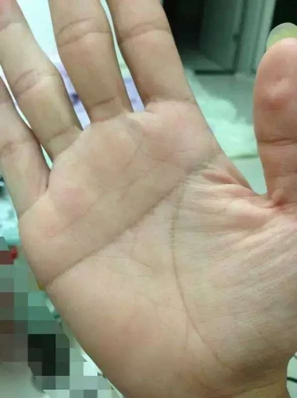 男人手相解析，多指特征与命运关联探讨插图