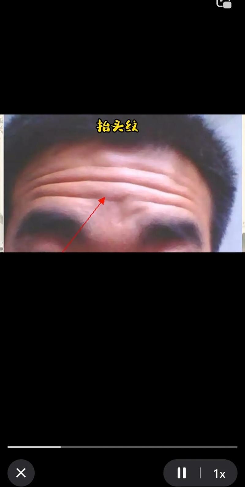 额头仰月纹全面解析，富贵抬头纹的奥秘，建议，额头纹路揭秘命运走向——解读富贵抬头纹的秘密插图