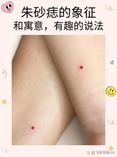 朱砂痣的特征与寓意，建议，朱砂痣，解析特征与运势影响插图