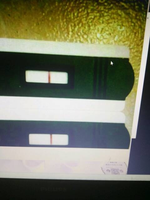 测男测女（测男测女z是指多少天开始可以测）插图