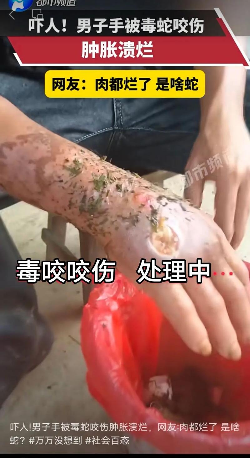 蟒蛇咬手预兆插图