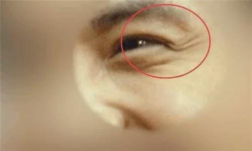 鱼尾纹上翘面相插图