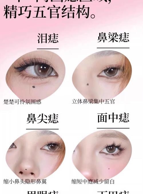 滴泪痣与泪痣详解，位置、特征与寓意插图