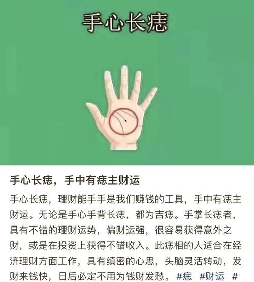掌心有痣，寓意富贵情缘与命运非凡的征兆插图