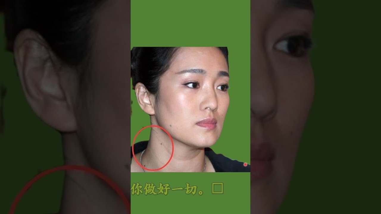 脖子后苦情痣与靠山痣解析，情感坎坷或贵人相助的命运象征插图