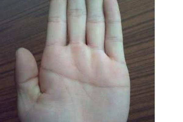 断掌男人命运分析，婚姻坎坷与克妻之说-红迪亚