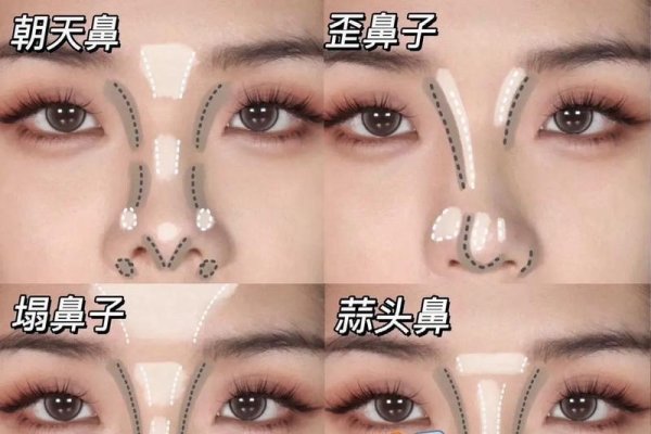 高鼻梁塑造技巧-红迪亚