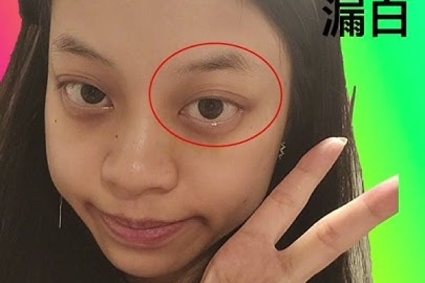 关于三白眼的面相解析，性格、运势与情感解读建议，揭秘三白眼神秘面纱下的个性特质和命运走向-红迪亚