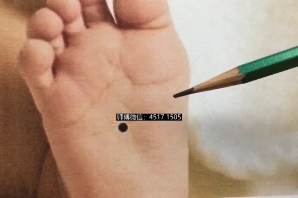 脚底痣相解读-红迪亚