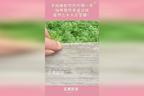 建议，梦到蛇咬手，预示好运与健康警示涵盖了文章的主要内容。-红迪亚