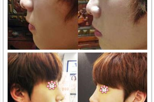 建议，揭秘有福男人面相特征，五官小巧、声音宏亮等成关键要素！-红迪亚