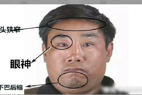 基于您提供的内容，以下是一个可能的标题，，面相揭秘之眼相解析，眼睛周围发黑的人性格与命运探讨-红迪亚