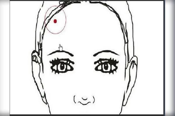 脸部痣相详解，不同位置含义大解析-红迪亚