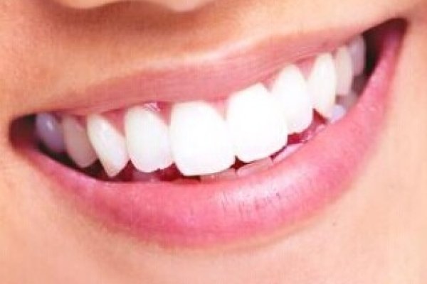 梦见掉牙寓意解析，健康、改变与心境的预兆-红迪亚