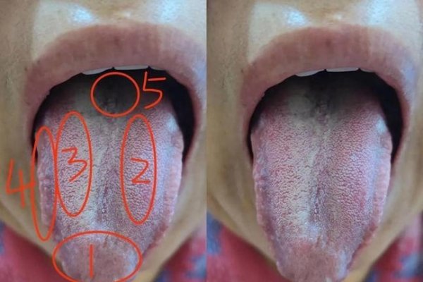 梦见舌头掉落的多重解读，沟通障碍、内心焦虑与运势波动预警-红迪亚