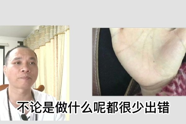 女人掌心痣相解析，富贵之兆-红迪亚