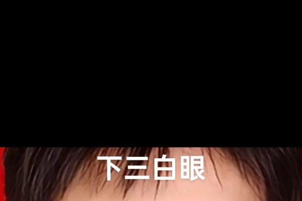 三白眼男性面相探究-红迪亚