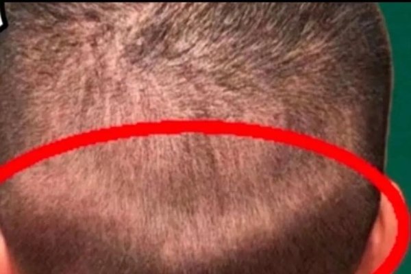 天生反骨，指枕骨突出的人。-红迪亚