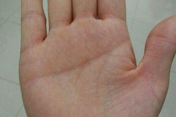 男人的手相解析，断掌、手指与命运关联揭秘-红迪亚