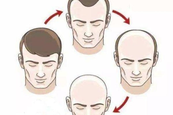 男人梦见掉发秃顶的多种解读-红迪亚