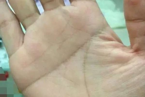 男人手相解析，多指特征与命运关联探讨-红迪亚