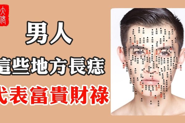 男人痣相详解，特殊寓意与运势分析-红迪亚