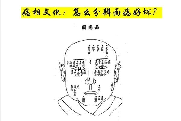 脖子痣面相图，吉凶参半需藏之辨-红迪亚